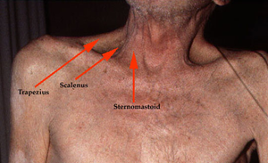 Fotoğraf aksesuarı muscle.png