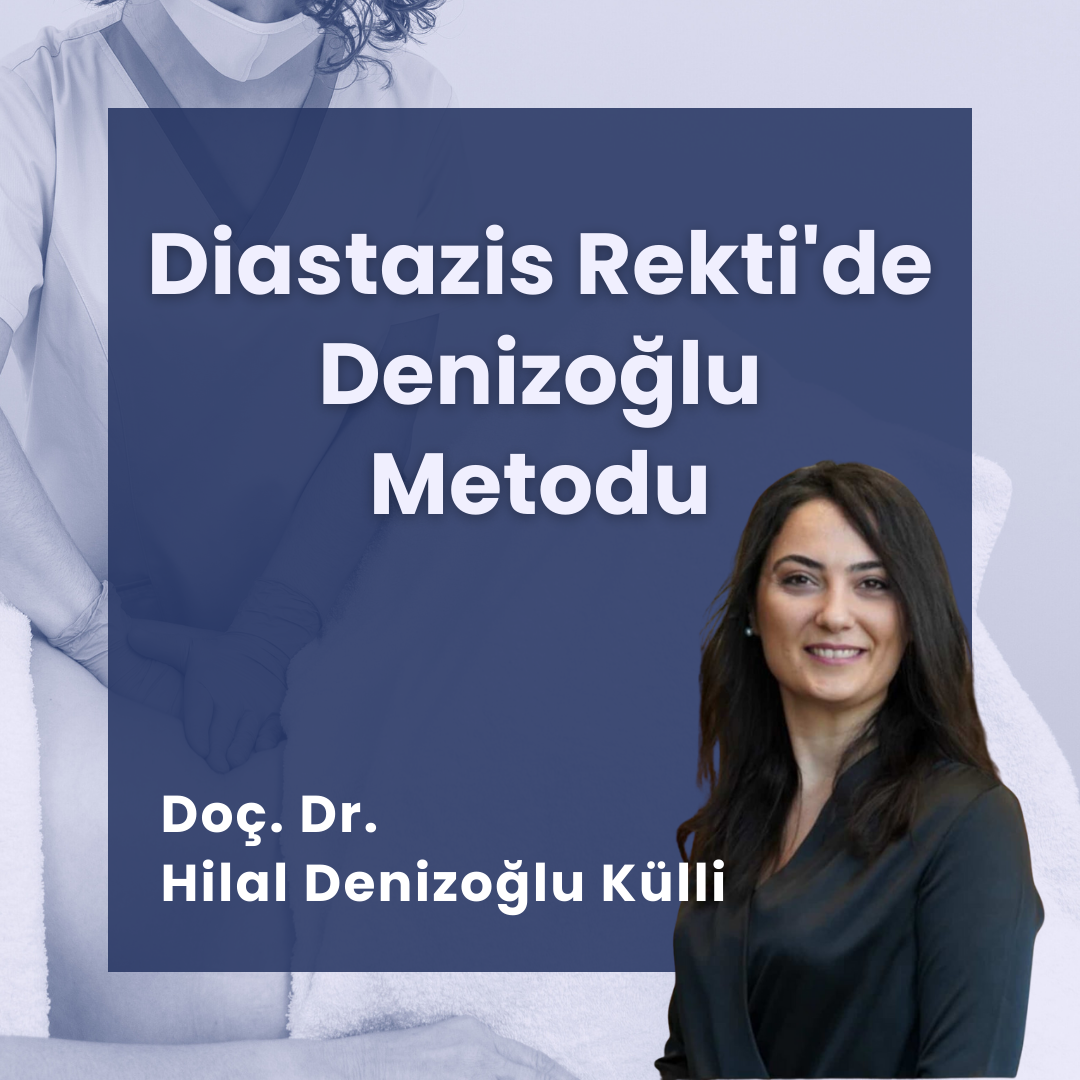 Diastazis Rekti'de Denizoğlu Metodu
